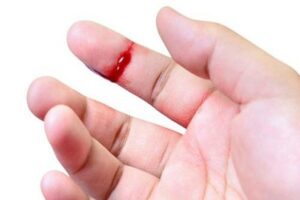 Nằm mơ thấy bị đứt tay chảy máu